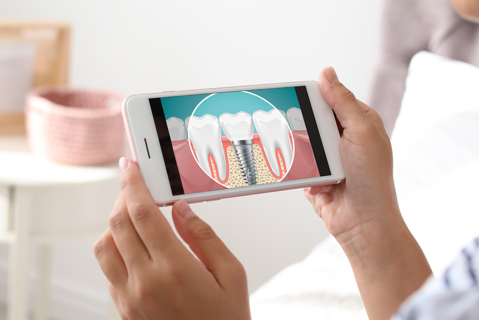 A person is using a smartphone to view an illustration of a tooth with a cavity and a dental implant.