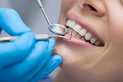 A woman receiving dental care, with a dental hygienist performing a cleaning procedure using a mirror and tools.