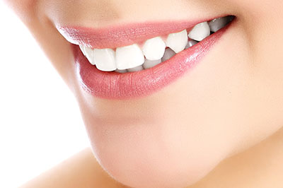 Close-up of a smiling woman showcasing her teeth, with an overlay text that reads  Teeth Whitening .