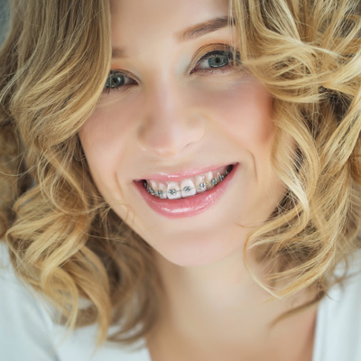 Smiling woman with straight teeth and braces, wearing a white top and curly blonde hair.