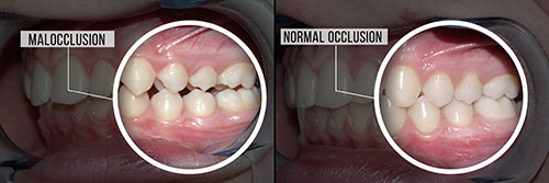 The image displays a before and after comparison of dental treatment, showcasing the transformation from a mouth with visible decay to one that is fully restored and healthy.