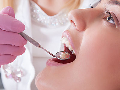 A dental professional performing a teeth cleaning procedure on a patient s mouth.